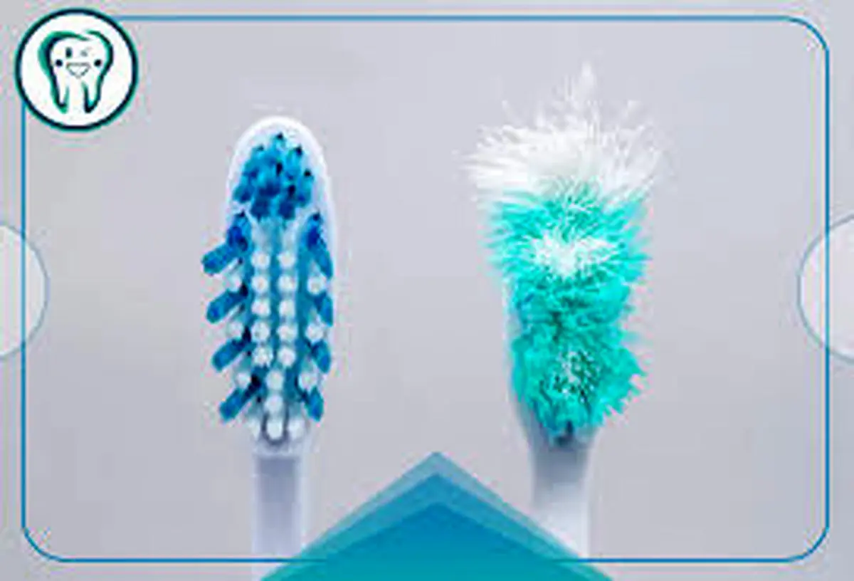 چه زمانی باید مسواک را عوض کرد؟