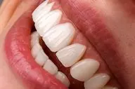 هشدار درباره تبلیغات فریبنده دندانپزشکی ارزان در فضای مجازی