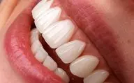 هشدار درباره تبلیغات فریبنده دندانپزشکی ارزان در فضای مجازی