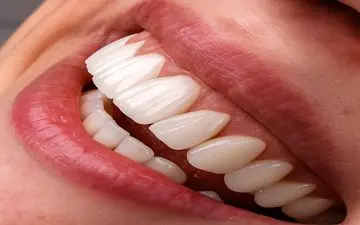 هشدار درباره تبلیغات فریبنده دندانپزشکی ارزان در فضای مجازی