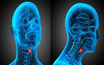 نشانه‌های هشداردهنده سرطان حنجره که باید بشناسید