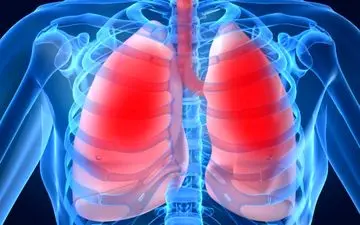 6عامل اصلی که باعث آسم می شود