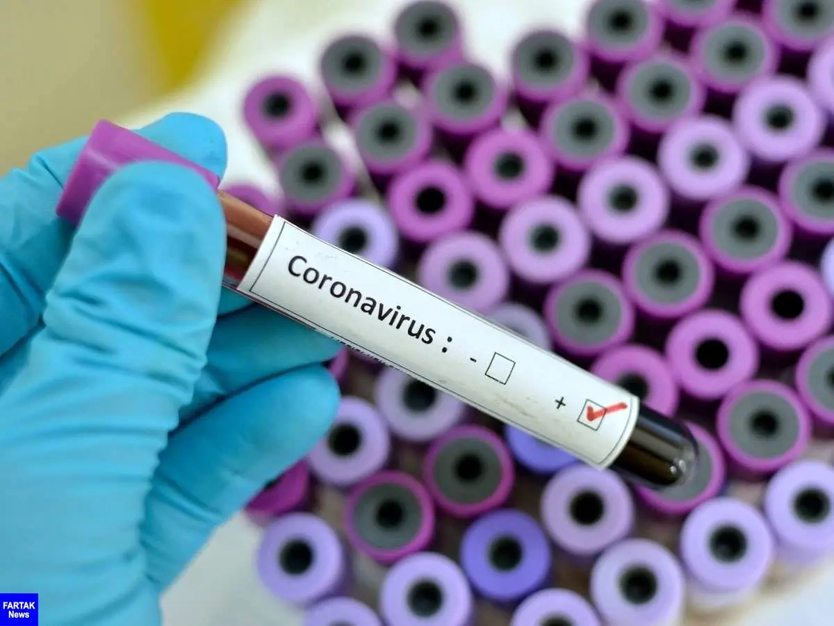 شناسایی نخستین بیمار مبتلا به ویروس کرونا در پاکستان

