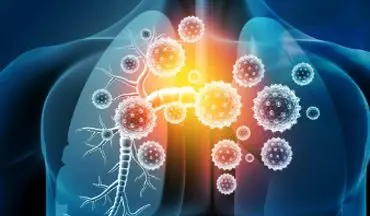 بیماری التهابی ریه را جدی بگیرید!