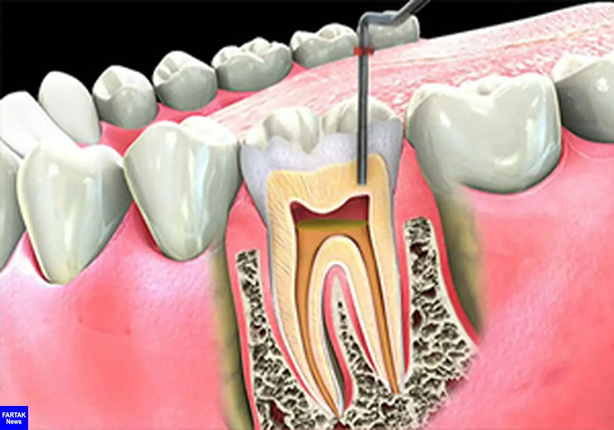  پوشش بیمه‌ای خدمات دندان‌پزشکی افزایش یافت 