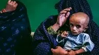 ابتلای نیمی از کودکان زیر ۵ سال افغان به سوء تغدیه شدید