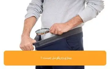  واریکوسل یکی از علل ناباروری در مردان