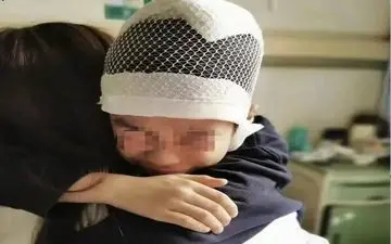 جدا شدن پوست سر و جمجمه کودک،تنبیه سخت معلم!