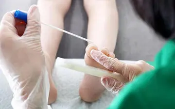 سرطان دهانه رحم در زنان و آن چه که باید بدانید/کشنده یا درمان دارد؟