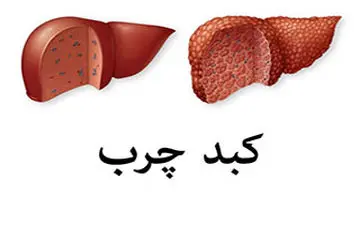 ابتلا به بیماری خاموش+فیلم