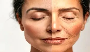 کاهش انرژی و چین و چروک/ آیا کمبود این ویتامین مقصر است؟