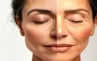 کاهش انرژی و چین و چروک/ آیا کمبود این ویتامین مقصر است؟