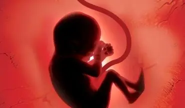 نوزاد هندی باردار متولد شد!+عکس