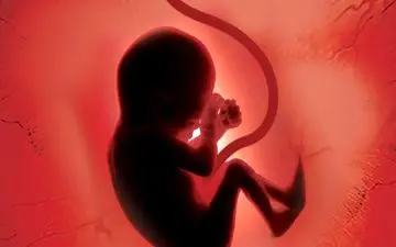 نوزاد هندی باردار متولد شد!+عکس