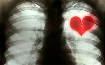 سندرم قلب شکسته، علائم و نحوه تشخیص این بیماری
