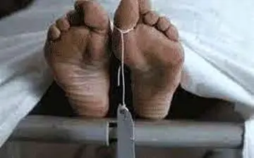 مرگ تلخ دختر بوشهری زیر تیغ جراحی زیبایی در تهران + جزییات