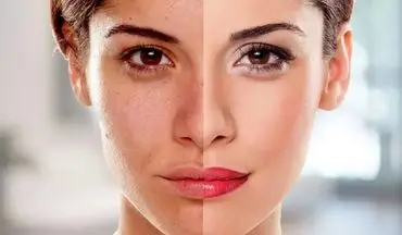 تأثیر تغذیه بر سلامت پوست؛ چه بخوریم تا پوستی درخشان داشته باشیم؟