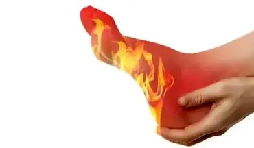 اگر کف پاهایتان می‌سوزد، بخوانید! چند نشانه خطرناک که باید فوراً به پزشک مراجعه کنید