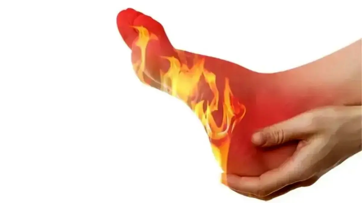 اگر کف پاهایتان میسوزد، بخوانید! چند نشانه خطرناک که باید فوراً به پزشک مراجعه کنید