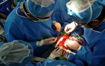 ایثار ماندگار یک مشهدی؛ اهدای اعضای بیمار مرگ مغزی، زندگی دوباره به 4 بیمار بخشید