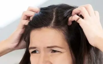 ترفندهای مفید برای مقابله با خارش پوست سر