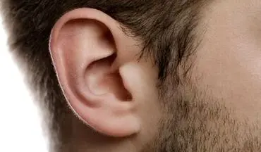 این علائم می‌گوید به پیرگوشی دچار شده‌اید