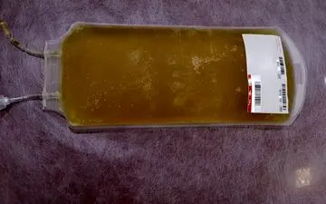 
تاثیر مثبت پلاسمای خون بر درمان بیماران مبتلا به کرونا
