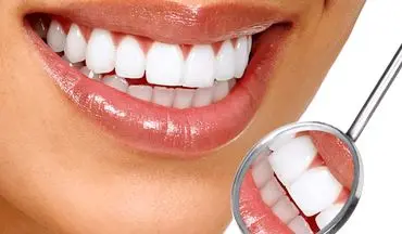 ۵ عادت ساده برای مراقبت از دندان‌ها
