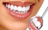 ۵ عادت ساده برای مراقبت از دندان‌ها