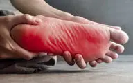 بی‌حسی و گزگز ساق پا نشانه چیست؟