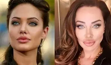 جراحی زیبایی خواننده ترک را شبیه به ستاره هالیوود کرد +عکس