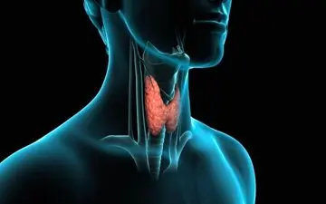 بیماری تیروئید | ۱۰ نشانه مخفی ابتلا به تیروئید