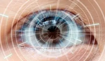 هوش مصنوعی، یاور جدید چشم‌پزشکان


