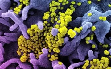 کرونا در ایلام آبی شد