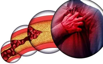 هر آنچه که باید درباره کلسترول بدانید