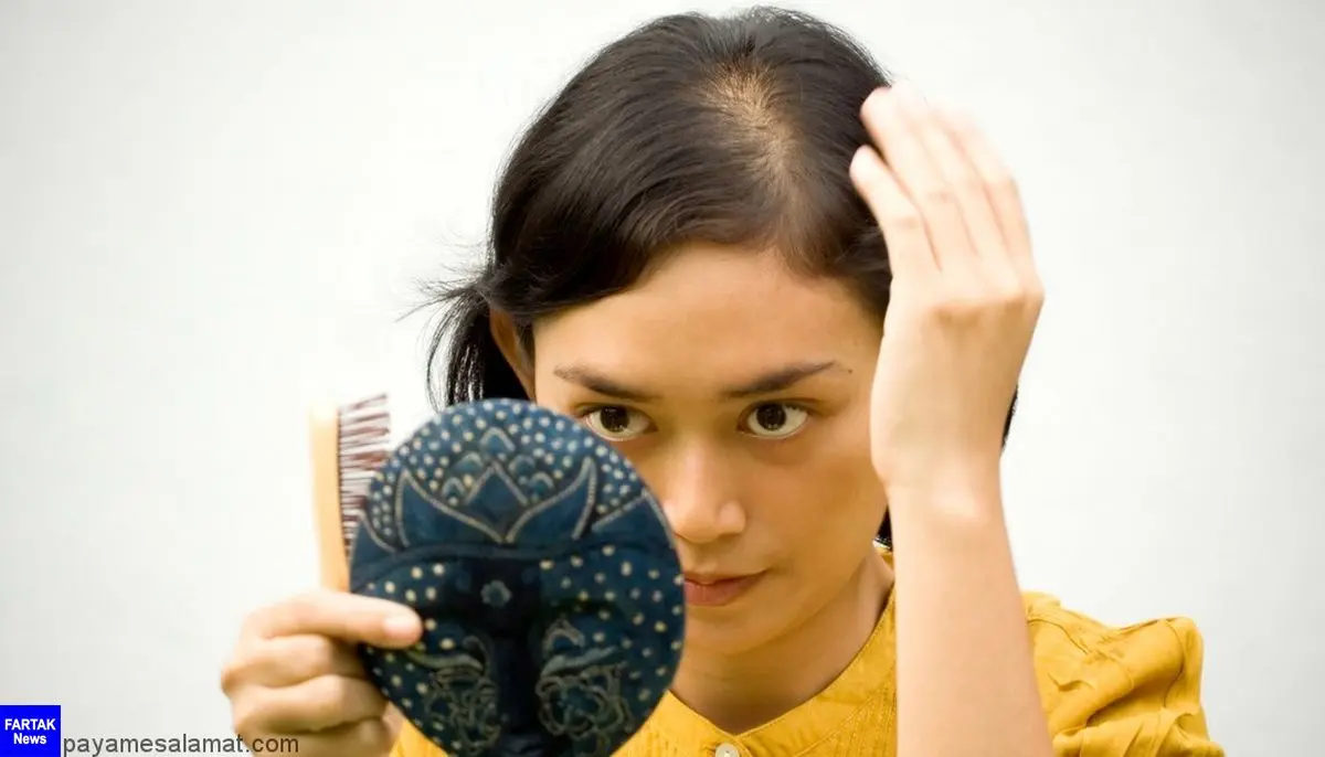 
چگونه از ریزش مو بعد از زایمان جلوگیری کنیم؟
