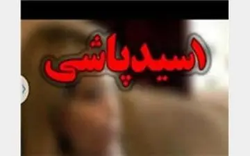 ازدواج قربانی اسیدپاشی های سریالی اصفهان +عکس