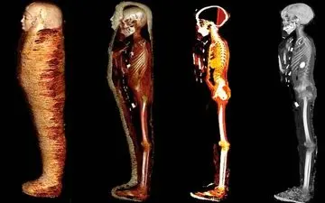 کشف جسد یک پسر با ۴۹ طلسم مختلف | پنهان کردن جواهر و طلا در بدن او