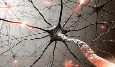 
ارتباط "بیماری نورون حرکتی" با کلسترول

