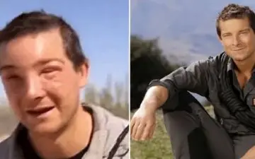 بلای وحشتناکی که زنبور‌ها بر سر مجری تلویزیونی آوردند