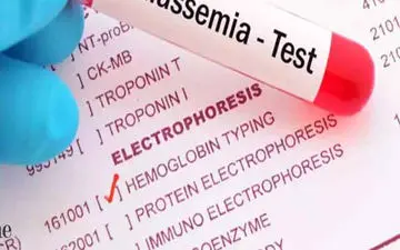 بیماری تالاسمی چیست؟ علائم تالاسمی چیست؟عوامل خطر در ابتلا به تالاسمی چیست؟