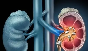 با مصرف این ۶ میوه‌ کلیه های شما فول انرژی می شود