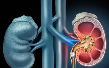 با مصرف این ۶ میوه‌ کلیه های شما فول انرژی می شود