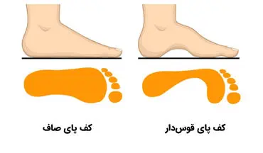 تست شخصیت قوس کف پا: نوع انحنای کف پا از ویژگی‌های شخصیتی شما خبر می‌دهد!
