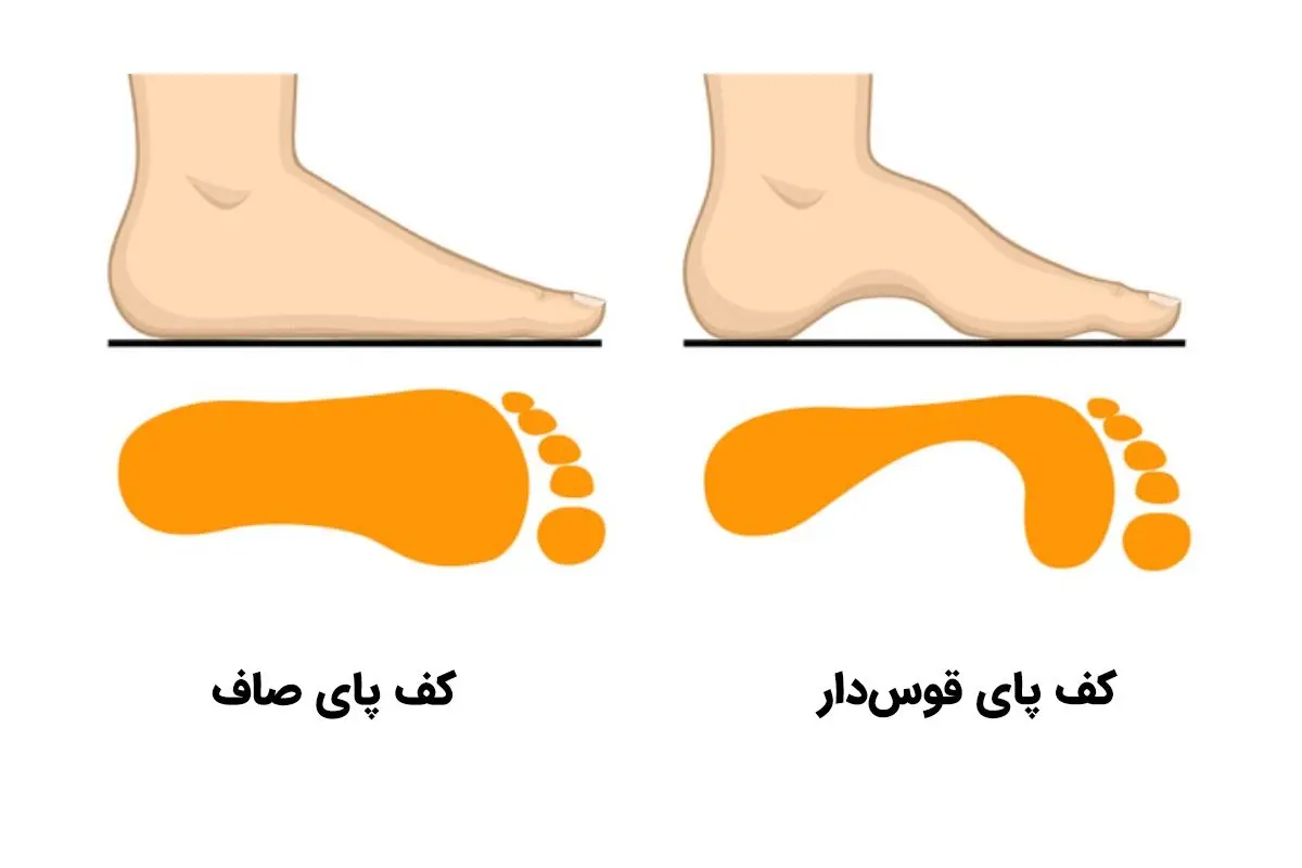 تست شخصیت قوس کف پا: نوع انحنای کف پا از ویژگی‌های شخصیتی شما خبر می‌دهد!
