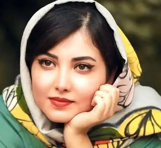 زیبا کرمعلی در ۲۸ سالگی | مقایسه چهره او با ۸ سال قبل + عکس