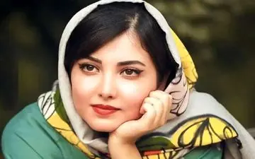 زیبا کرمعلی در ۲۸ سالگی | مقایسه چهره او با ۸ سال قبل + عکس