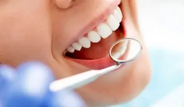 هر آنچه باید از پوسیدگی دندان بدانید