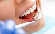هر آنچه باید از پوسیدگی دندان بدانید