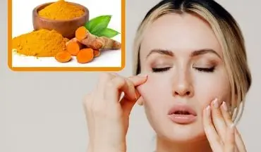 بهترین ماسک زردچوبه برای زیبایی و جوانی پوست صورت
